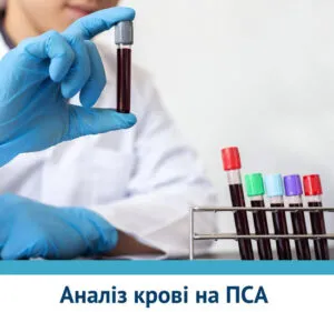 Анализ крови на ПСА