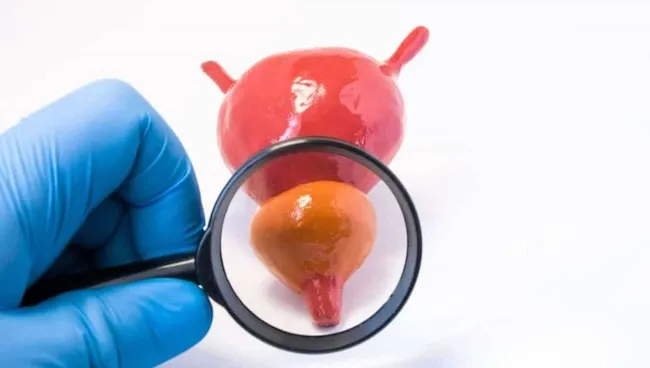 Что такое простатспецифический антиген (ПСА)