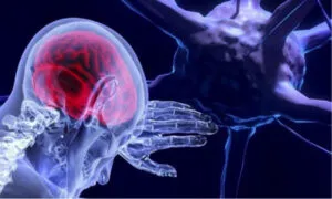 Пухлини головного мозку: фактори ризику та діагностика