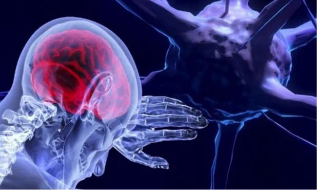 Пухлини головного мозку: фактори ризику та діагностика