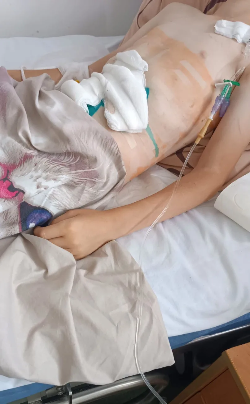 У Смілі велосипедист збив 10-річного хлопчика і тепер відповідатиме перед законом
