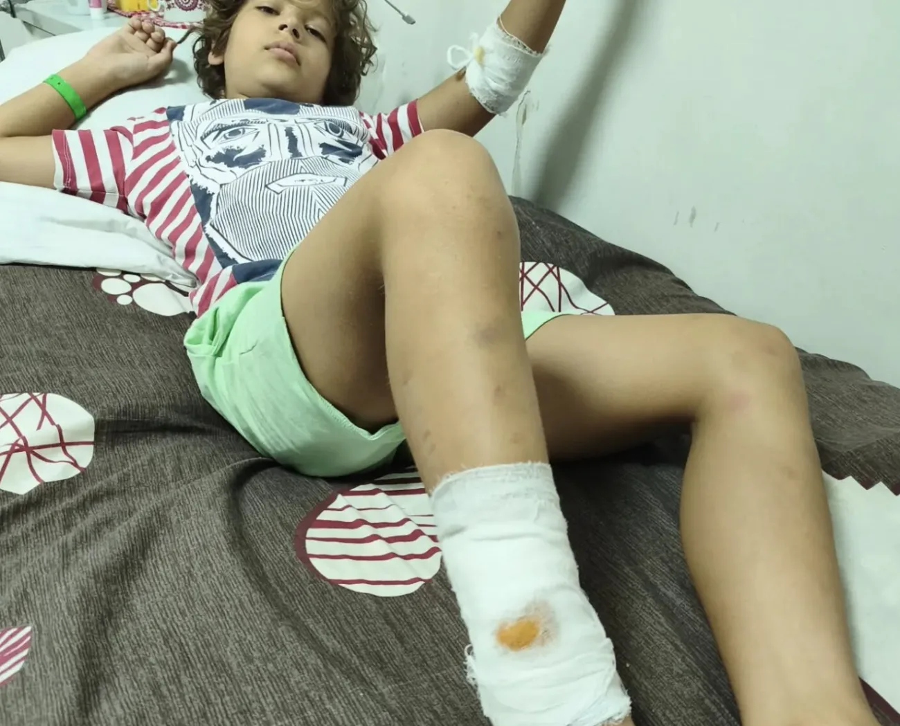 На Черкащині підстрелили 10-річного хлопчика: поліція встановлює особу стрільця